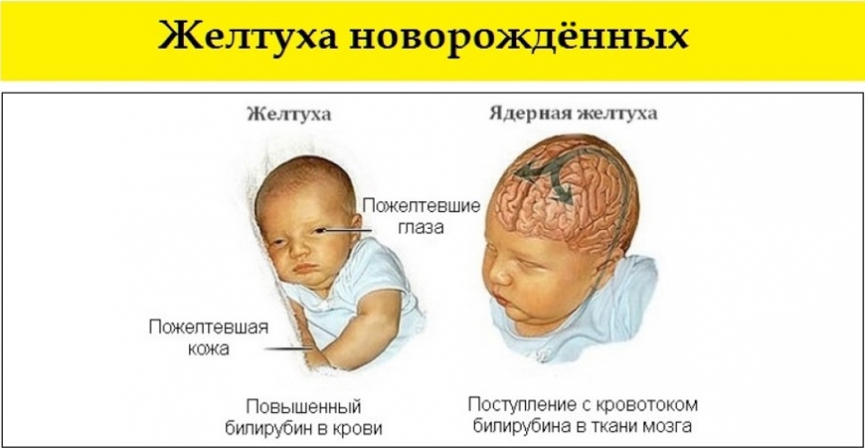 Нормальная форма головы ребенка | SBS-MED